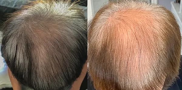 Hair Services at Skelix