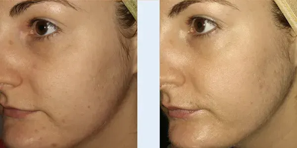 Aesthetic Services at Skelix